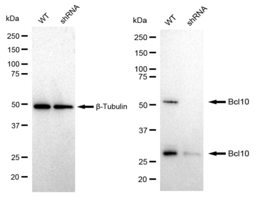 Bcl-10 Antibody (23GB1410)