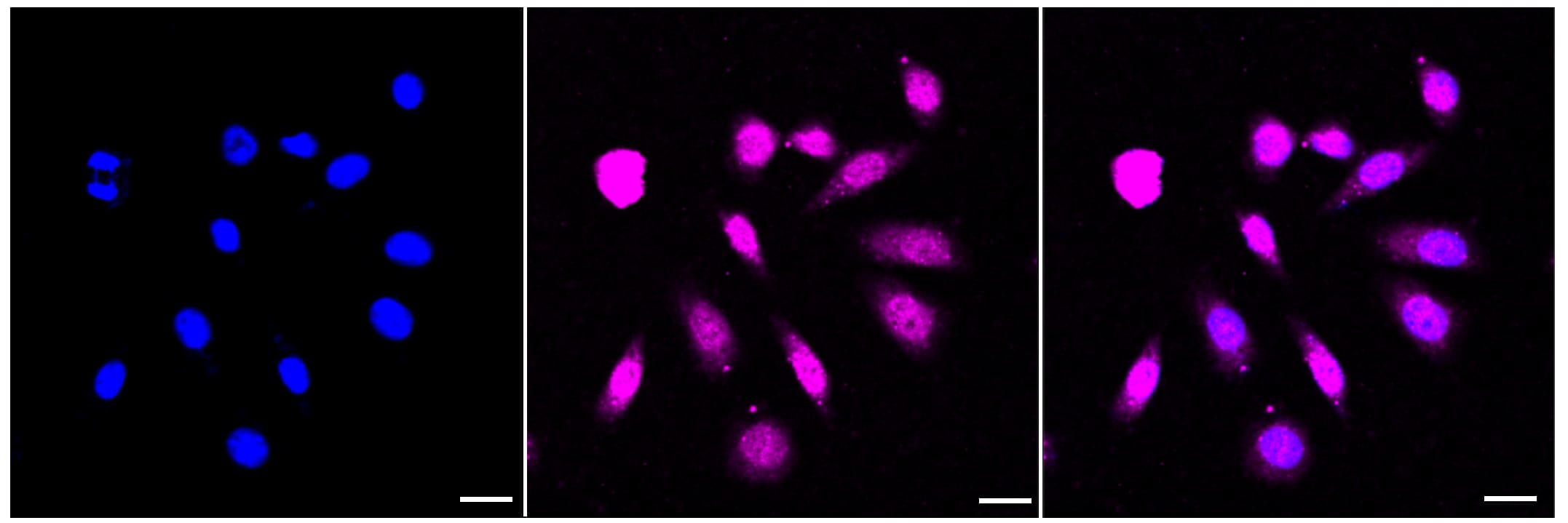 ACADVL Antibody (23GB3615)