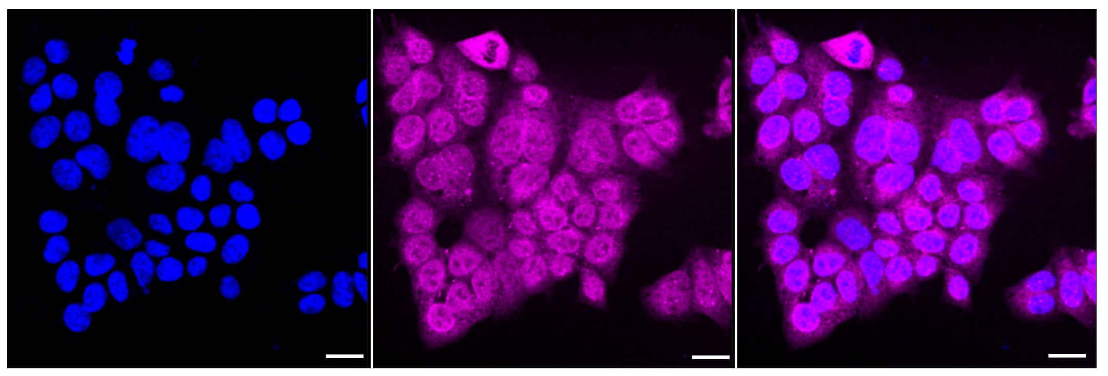 Calnexin Antibody (23GB2760)