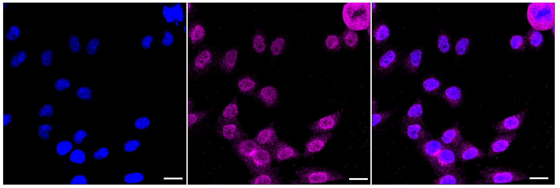 Apolipoprotein E R2/ApoE R2 Antibody (23GB2520)