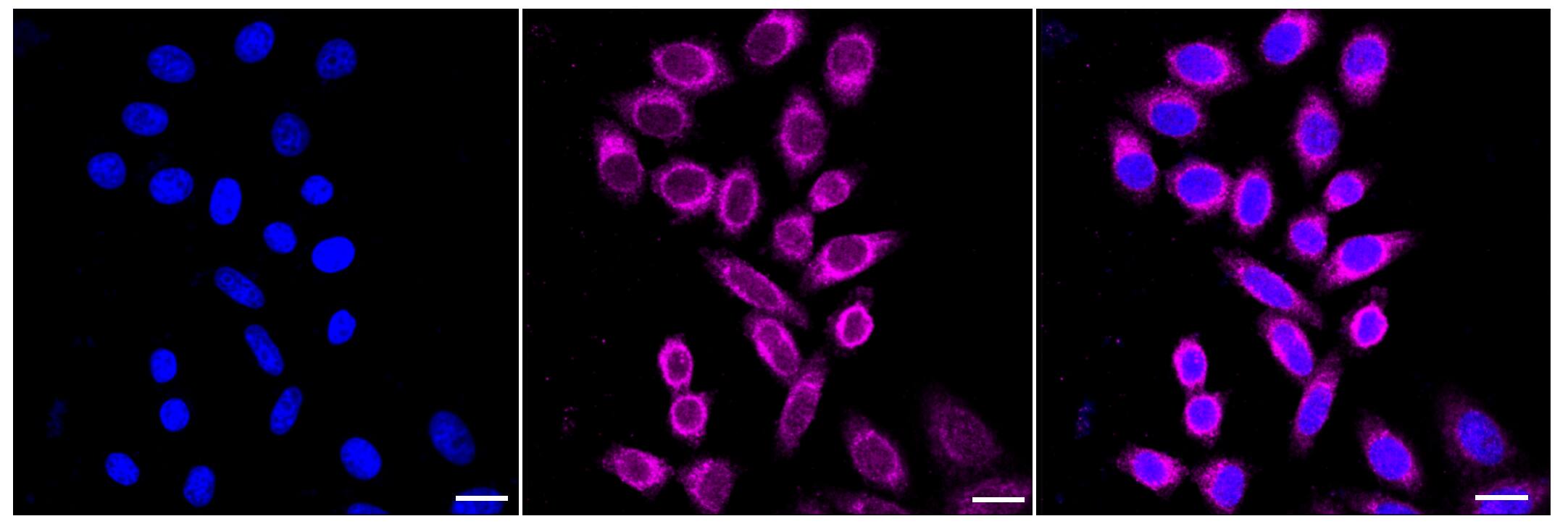 MLKL Antibody (23GB2935)