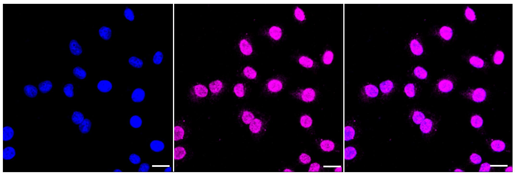 MLKL Antibody (23GB2895)
