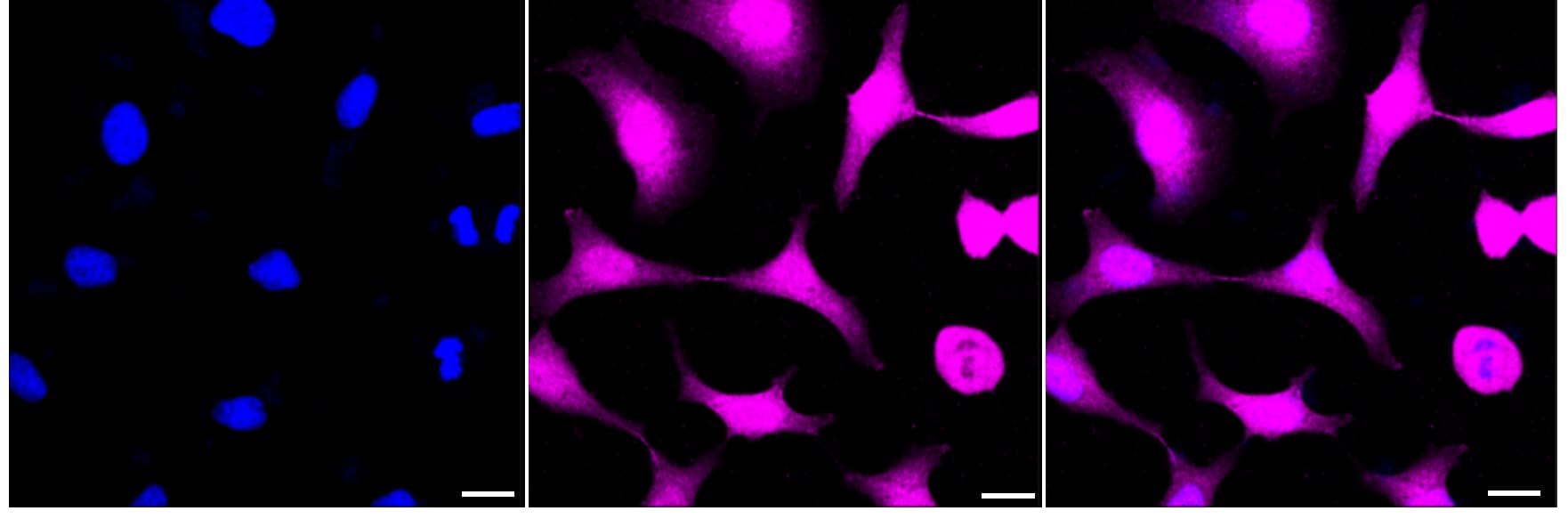 AKR1C1/2 Antibody (23GB3175)