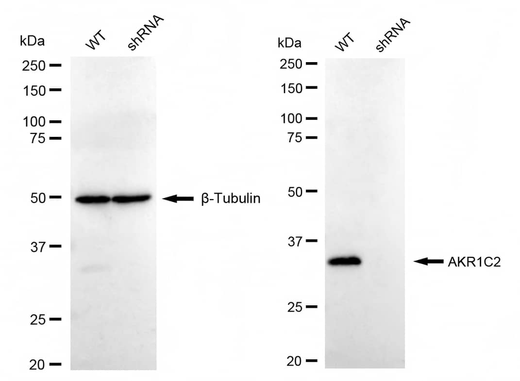 AKR1C1/2 Antibody (23GB3175)