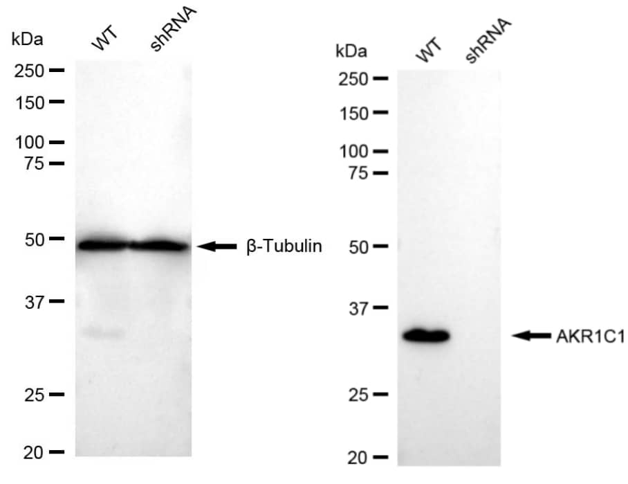 AKR1C1/2 Antibody (23GB3175)