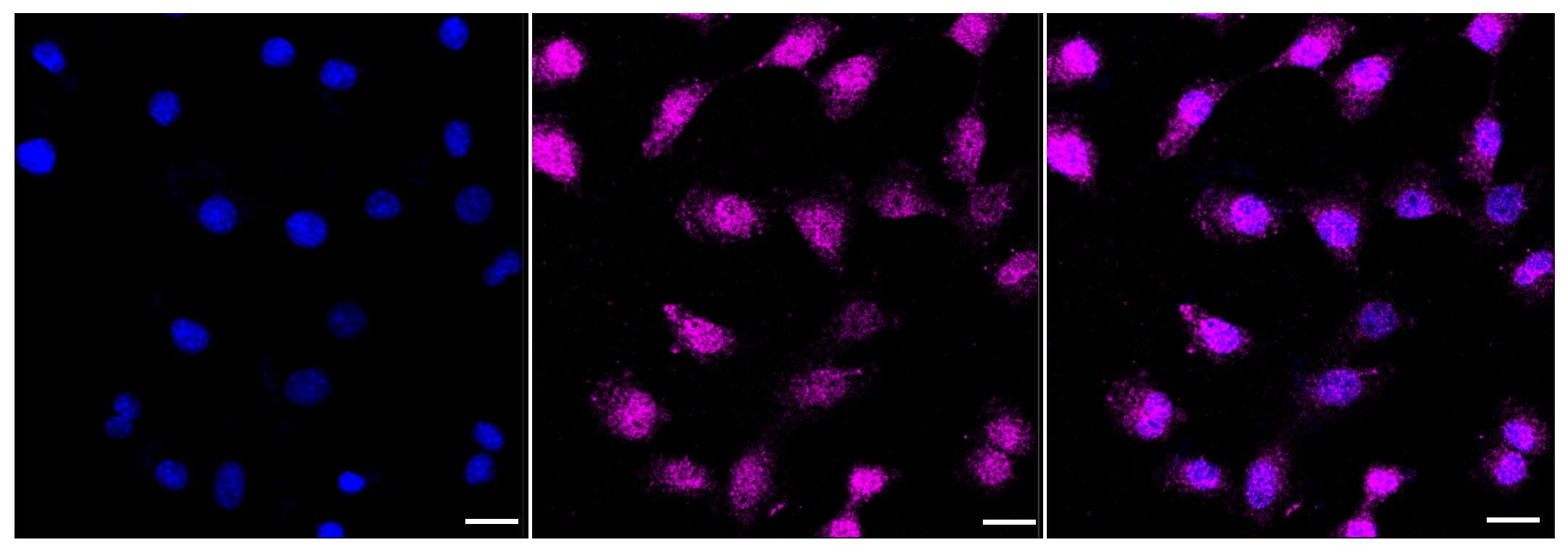 ATG4B Antibody (23GB3240)