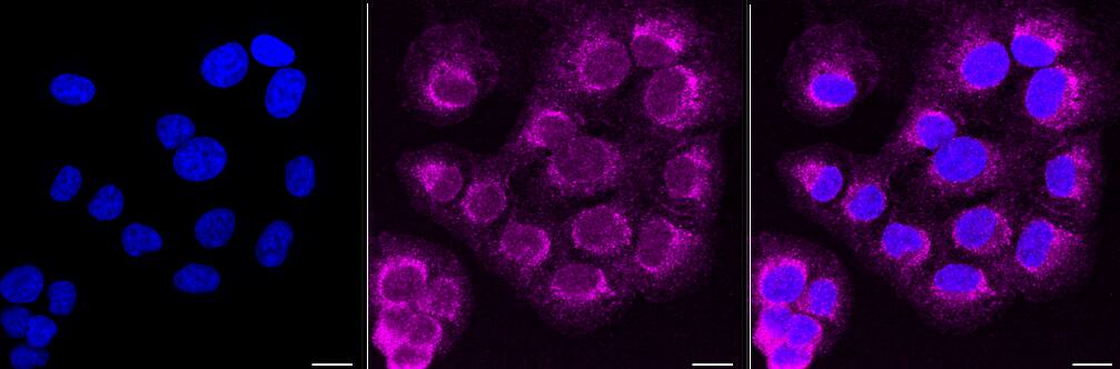 ATG16L1 Antibody (23GB665)