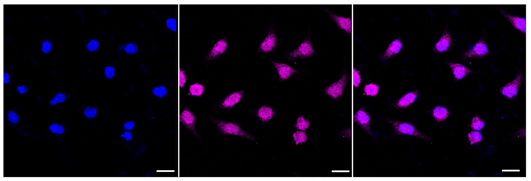 IFT88 Antibody (23GB4015)
