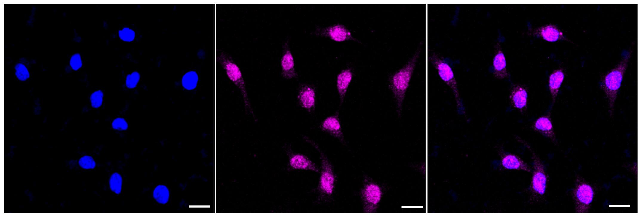 MTH1 Antibody (23GB4060)