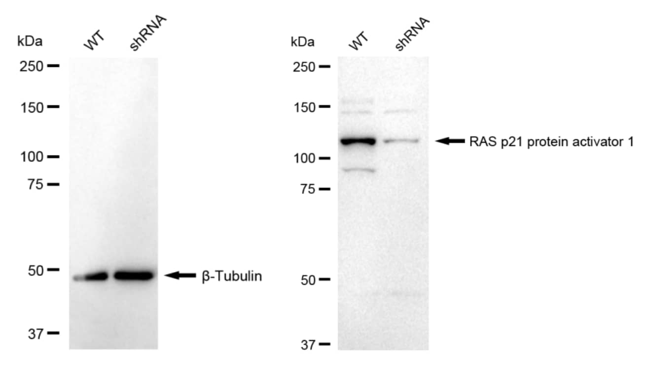 Ras-GAP Antibody (23GB4125)
