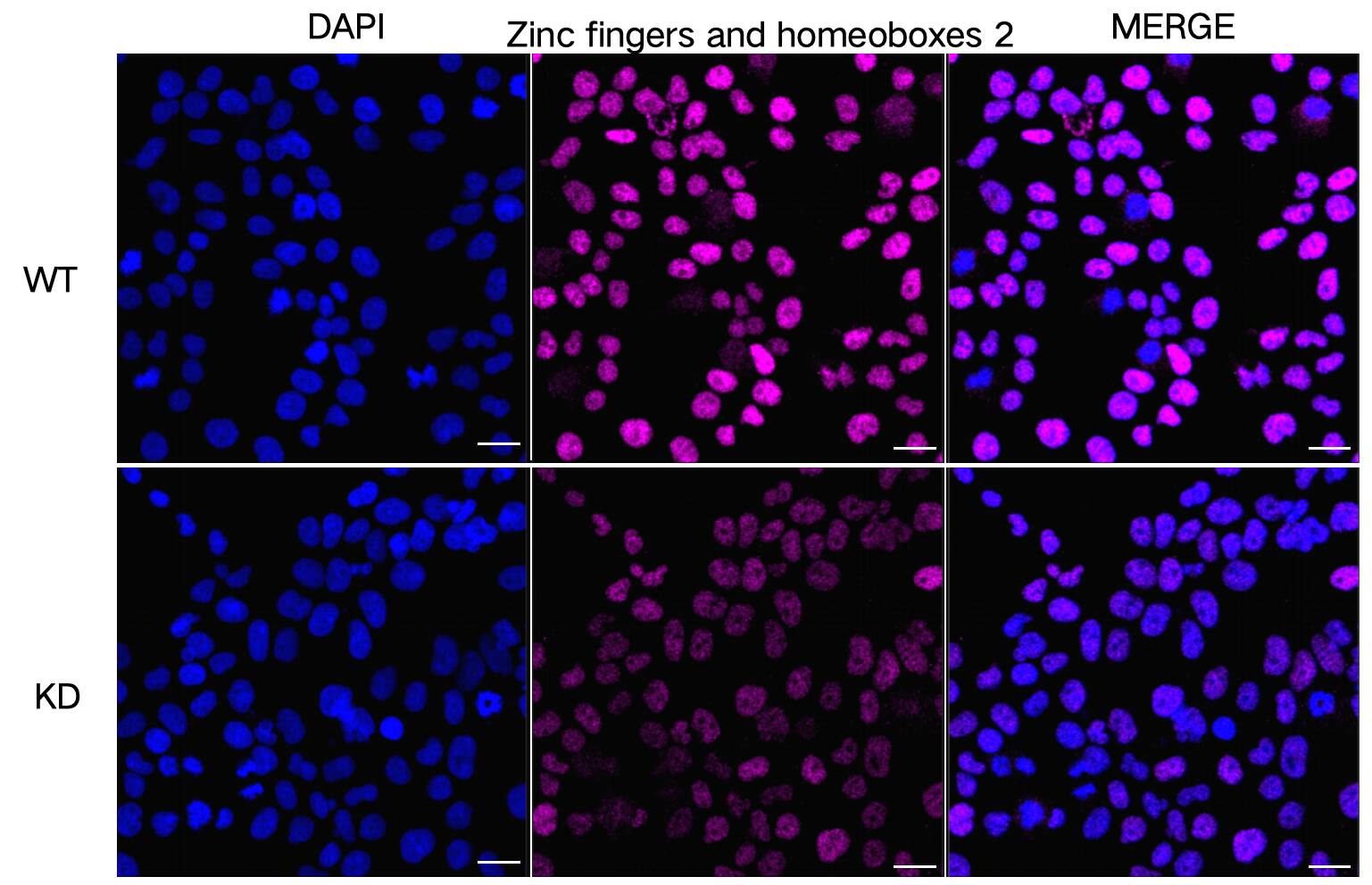 ZHX2 Antibody (23GB4270)