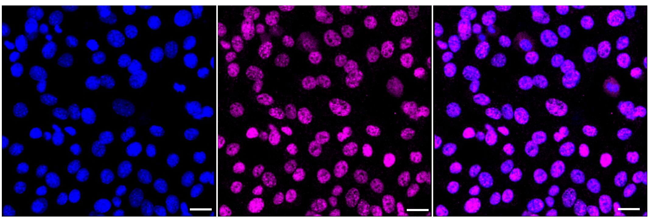 ZHX2 Antibody (23GB4270)