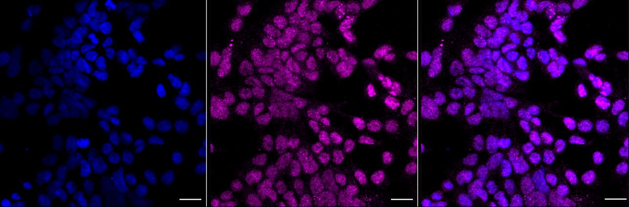 Rad51 Antibody (23GB4600)