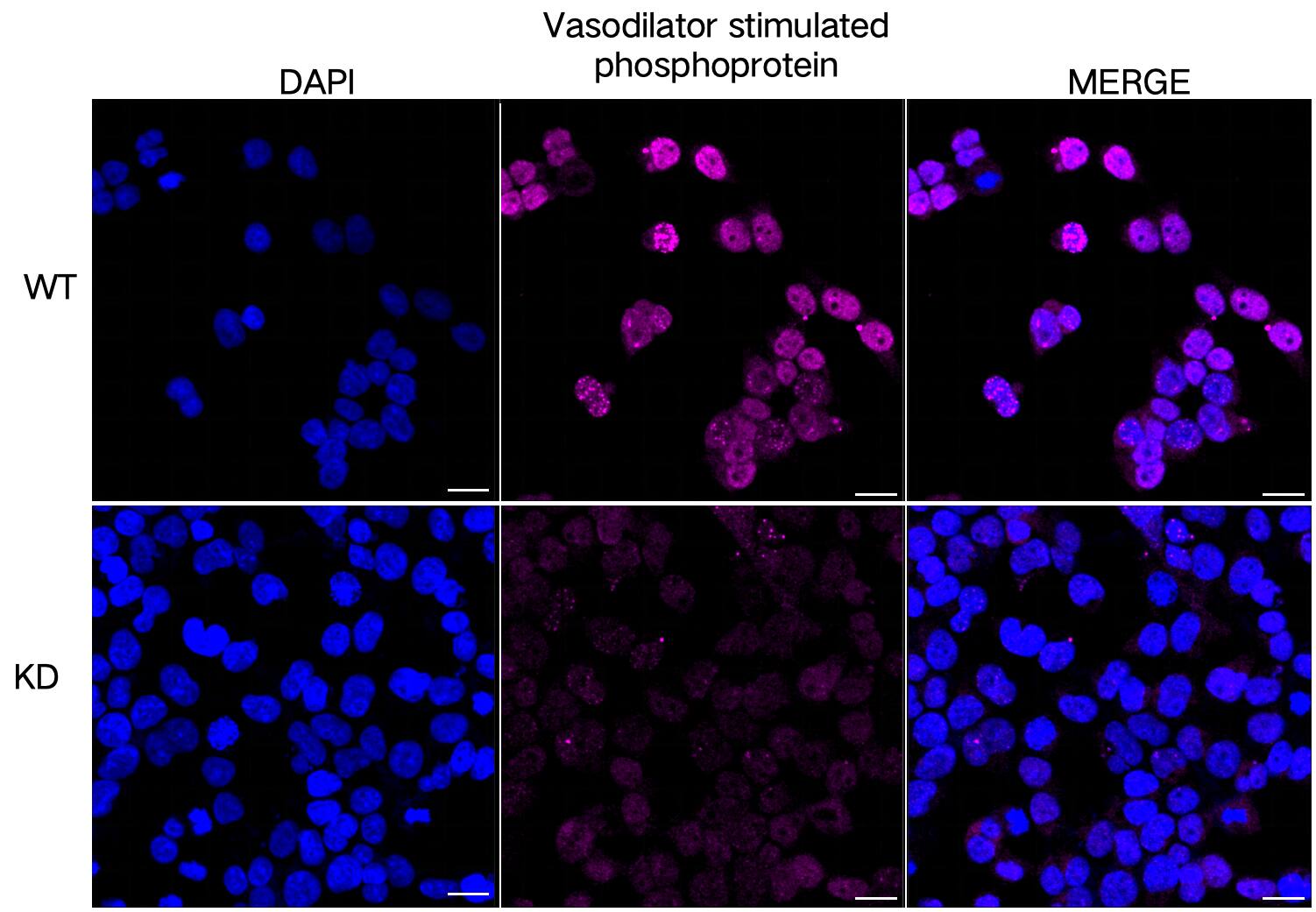 VASP Antibody (23GB4715)