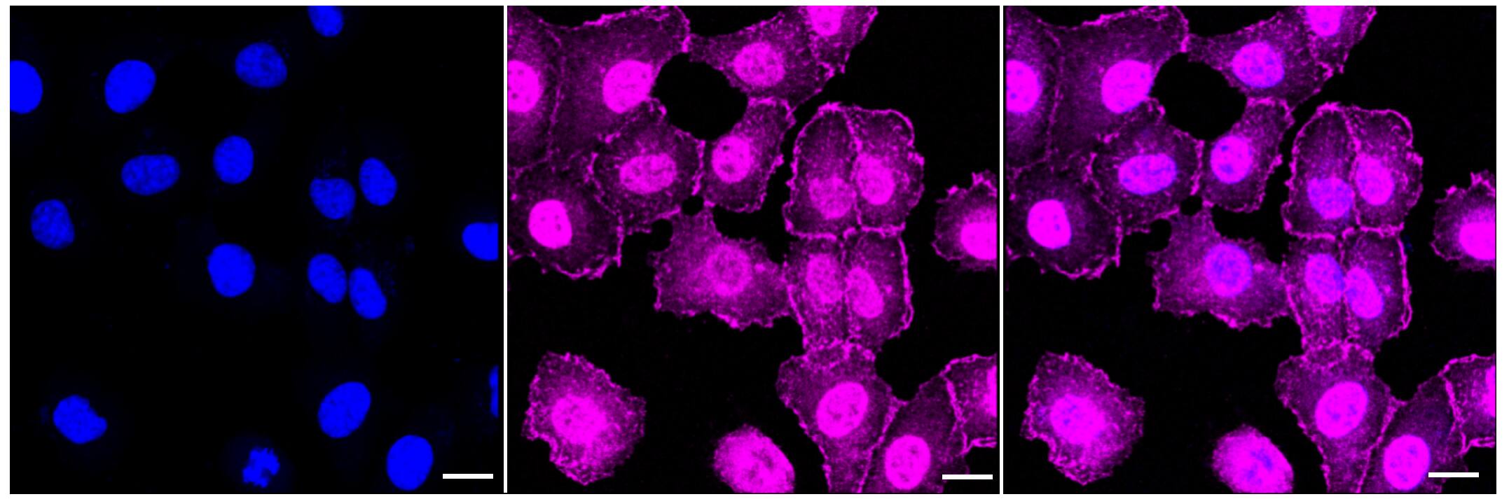 VASP Antibody (23GB4715)