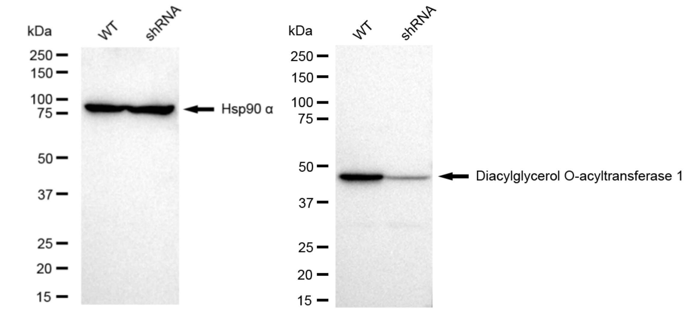 DGAT1 Antibody (23GB5155)