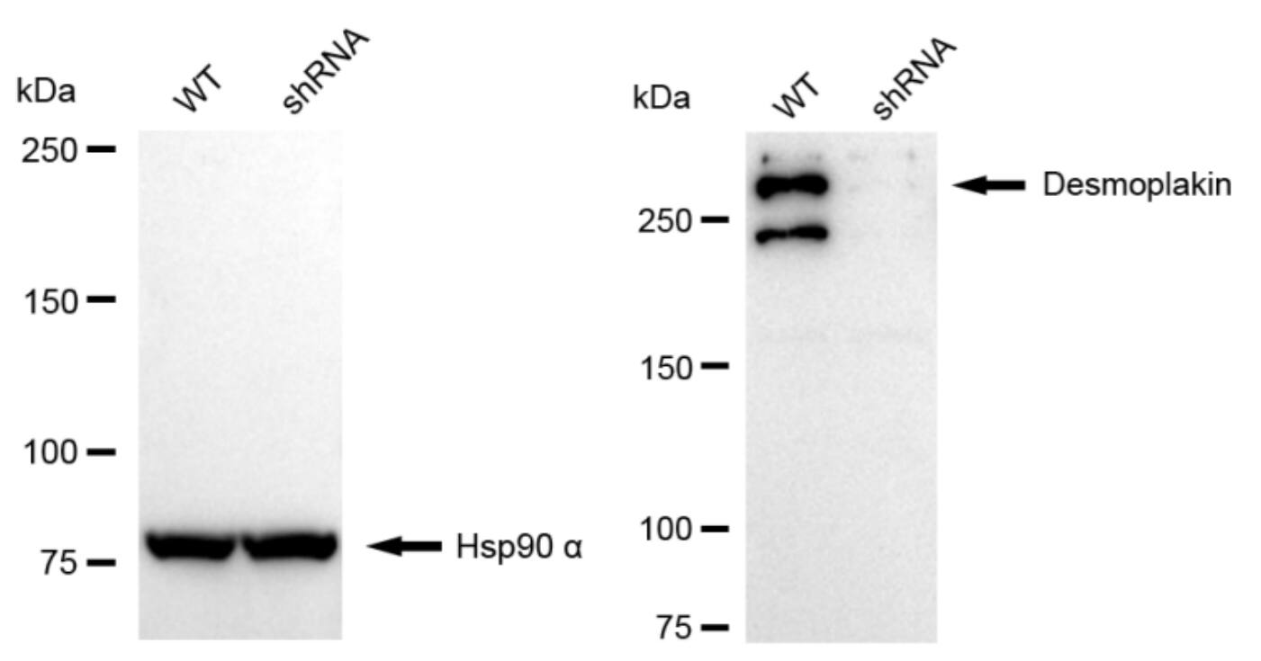 Desmoplakin Antibody (23GB5220)