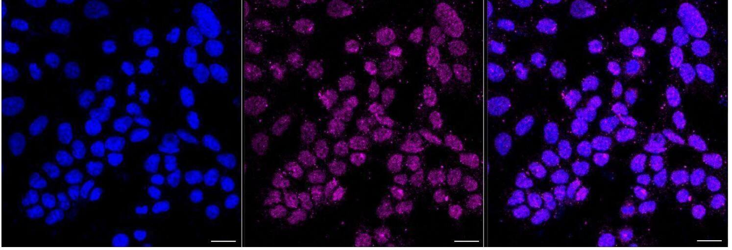 Cytokeratin 10 Antibody (23GB6105)