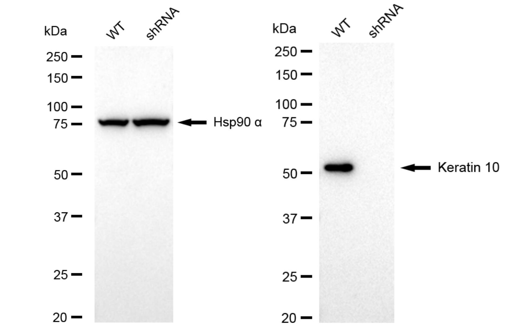Cytokeratin 10 Antibody (23GB6105)
