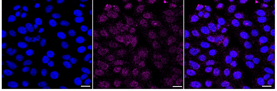 SR-BI Antibody (24GB1395)