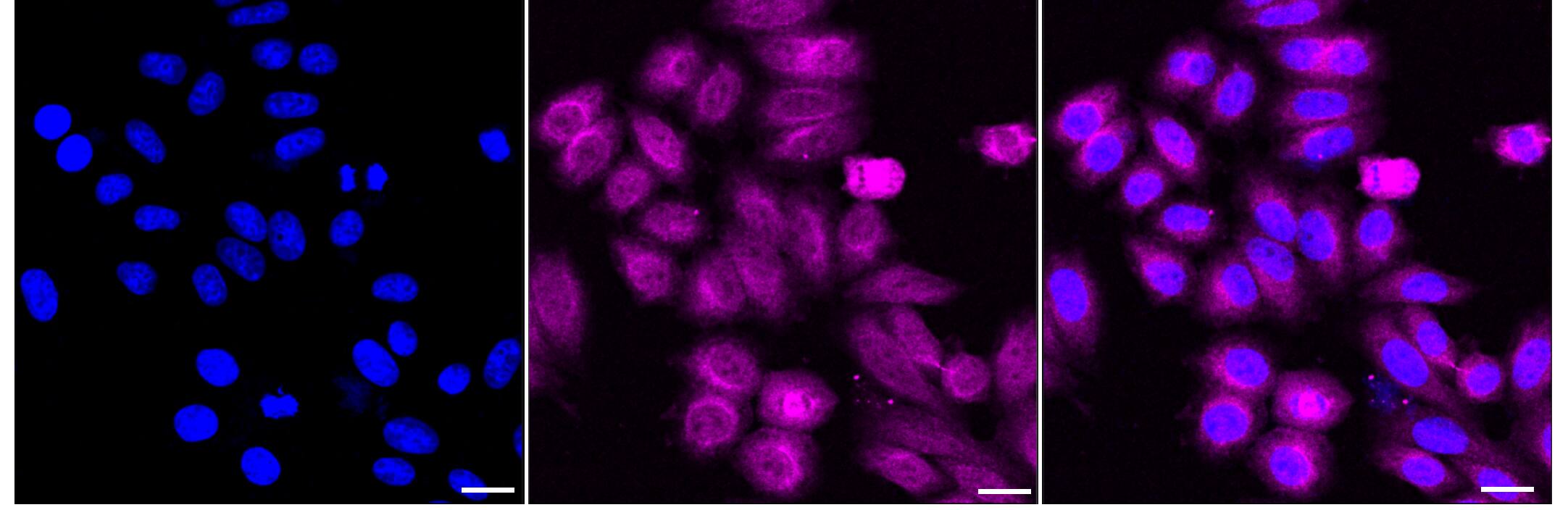 Huntingtin Antibody (23GB6285)