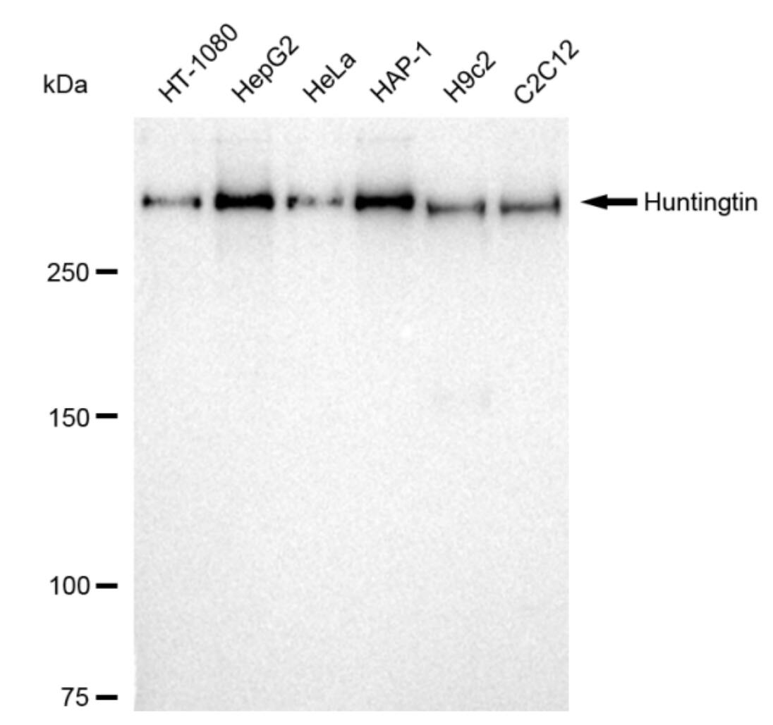 Huntingtin Antibody (23GB6285)