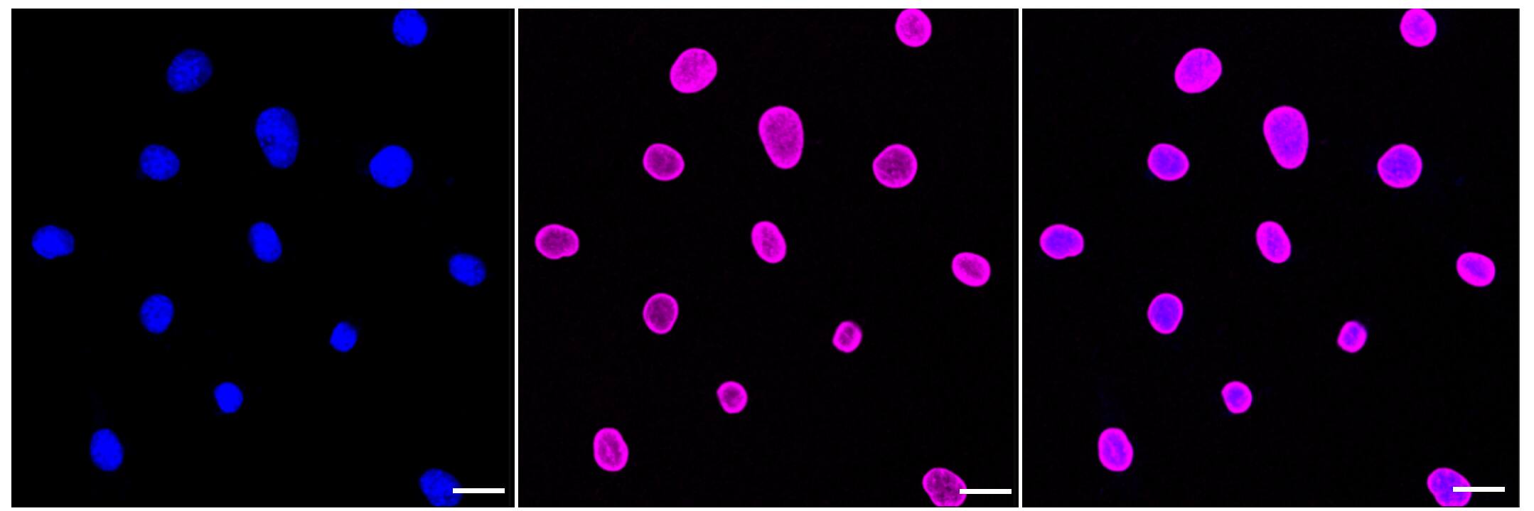 E2F-1 Antibody (23GB1505)