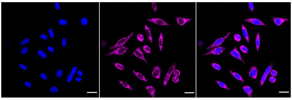 CECR5 Antibody (23GB6585)