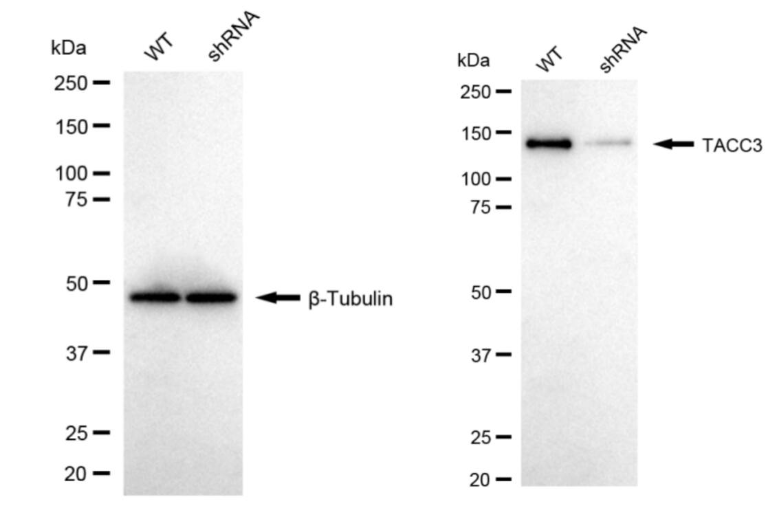 TACC3 Antibody (24GB1940)