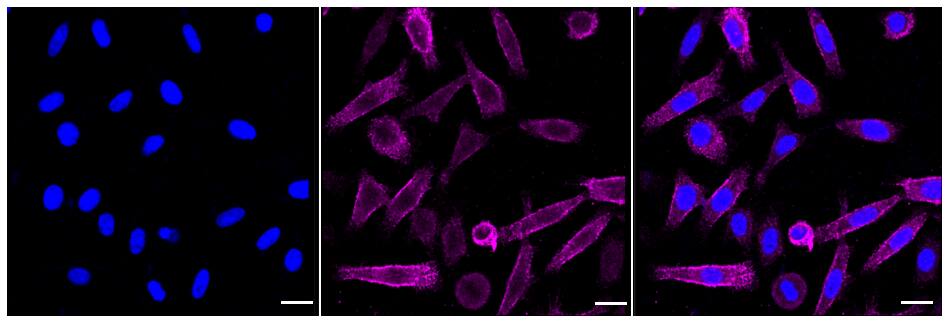 Moesin Antibody (24GB265)