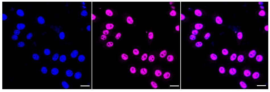 TOR/mTOR [p Ser2481] Antibody (24GB325)