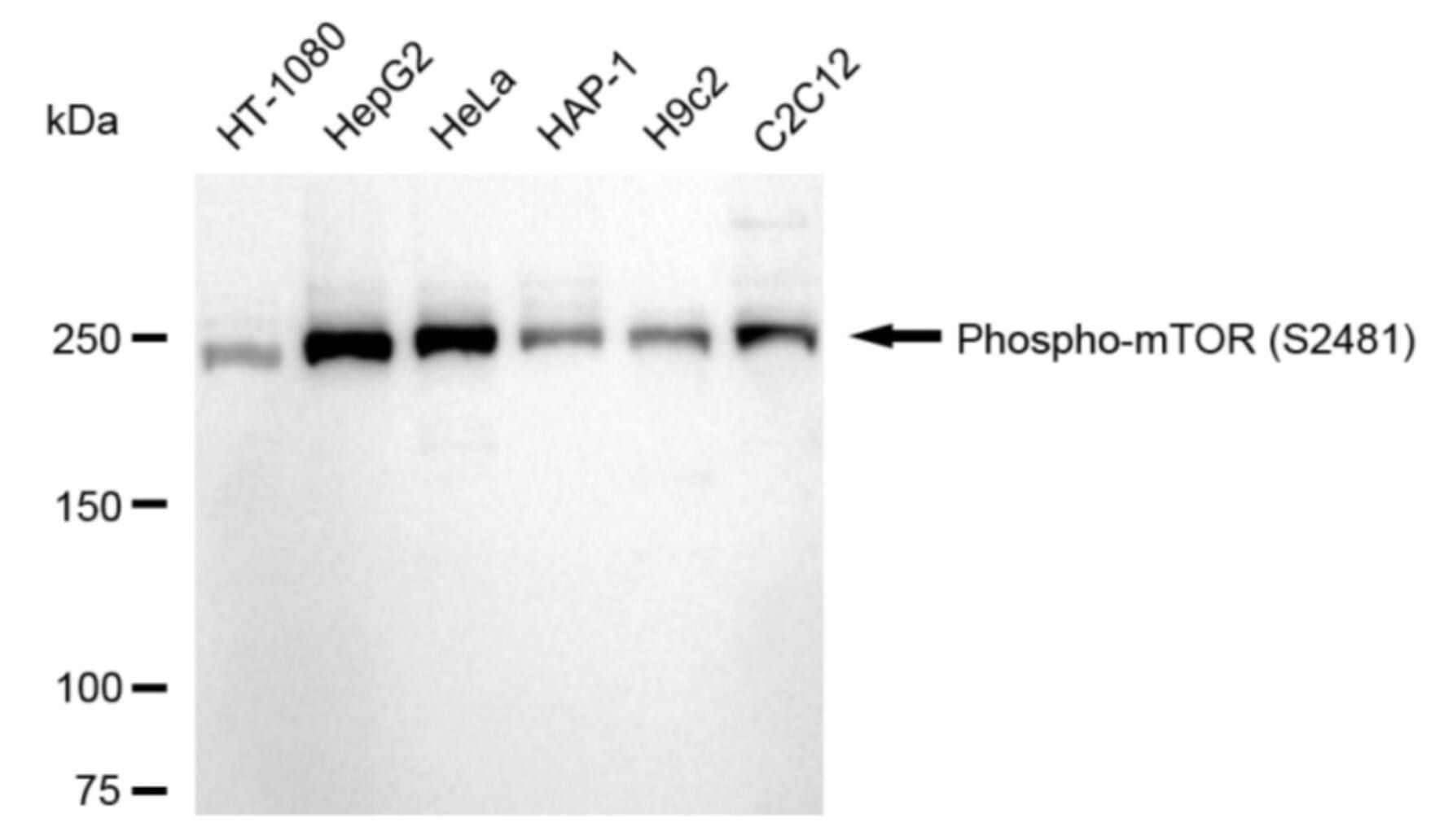 TOR/mTOR [p Ser2481] Antibody (24GB325)