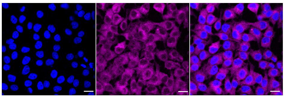 TOR/mTOR [p Ser2448] Antibody (24GB330)