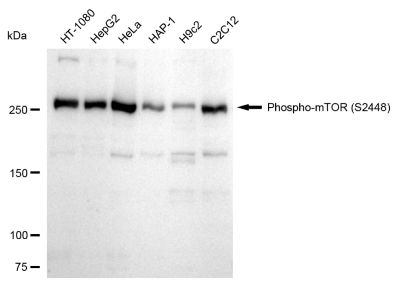 TOR/mTOR [p Ser2448] Antibody (24GB330)