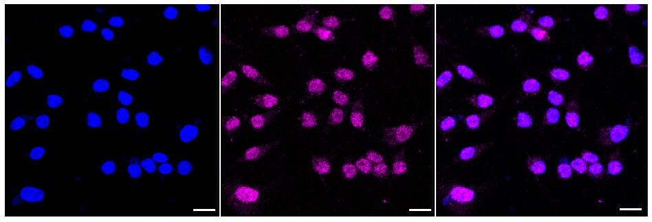 MVP Antibody (24GB465)