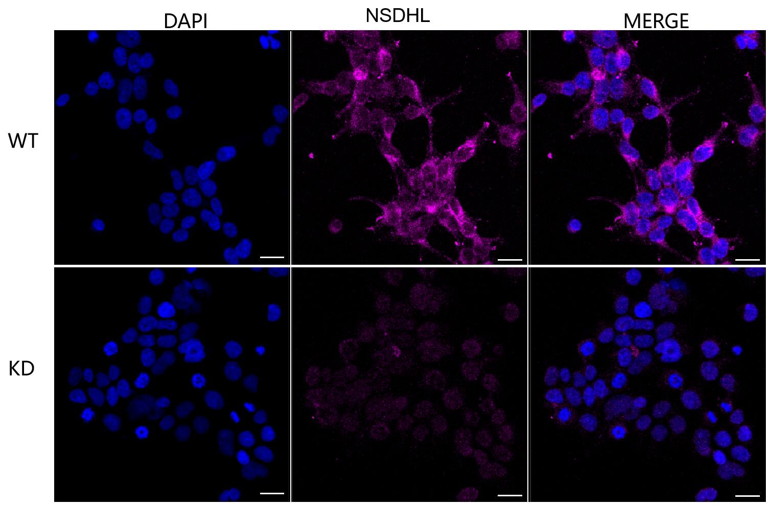 NSDHL Antibody (24GB485)