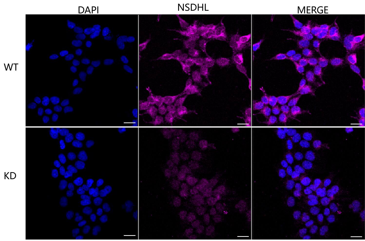 NSDHL Antibody (24GB510)