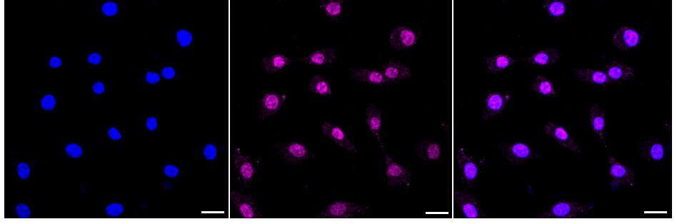 OLFM4 Antibody (24GB680)
