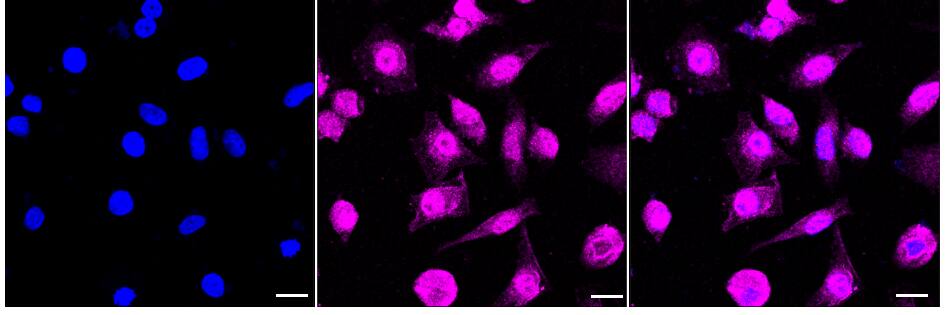 RAVER2 Antibody (24GB810)