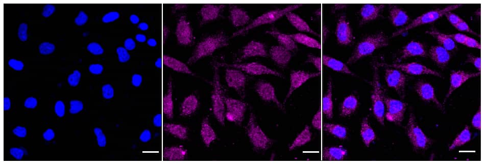 PRMT5 Antibody (24GB845)