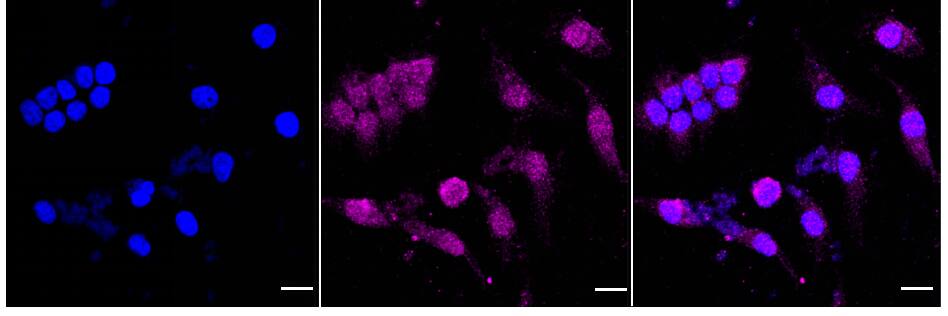 RKIP/PBP Antibody (24GB860)