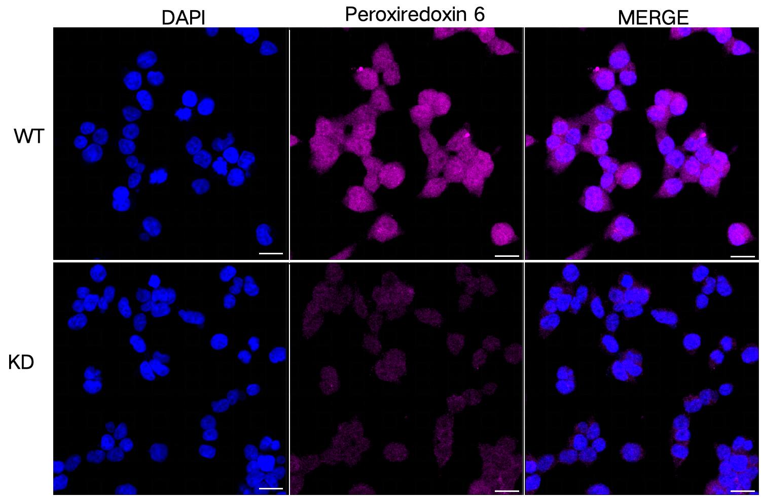 Peroxiredoxin 6 Antibody (24GB910)