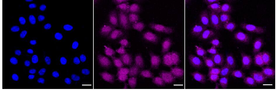 Peroxiredoxin 6 Antibody (24GB910)