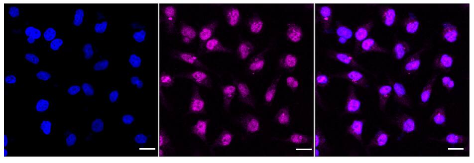 DNA Polymerase gamma Antibody (24GB1085)