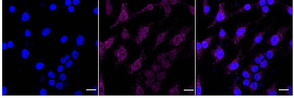 VPS34 Antibody (24GB1150)