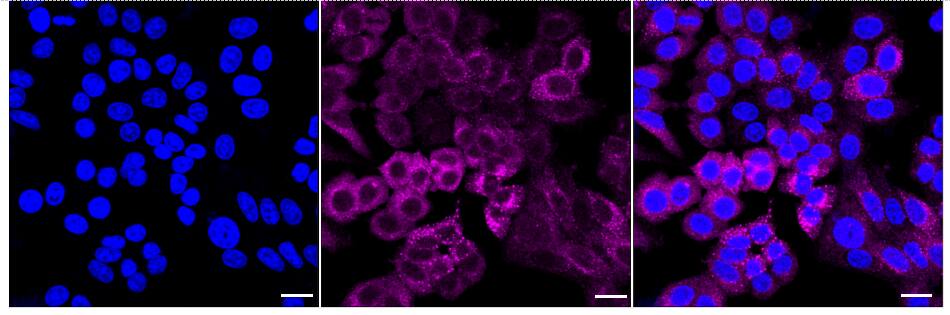 TFG Antibody (24GB2115)