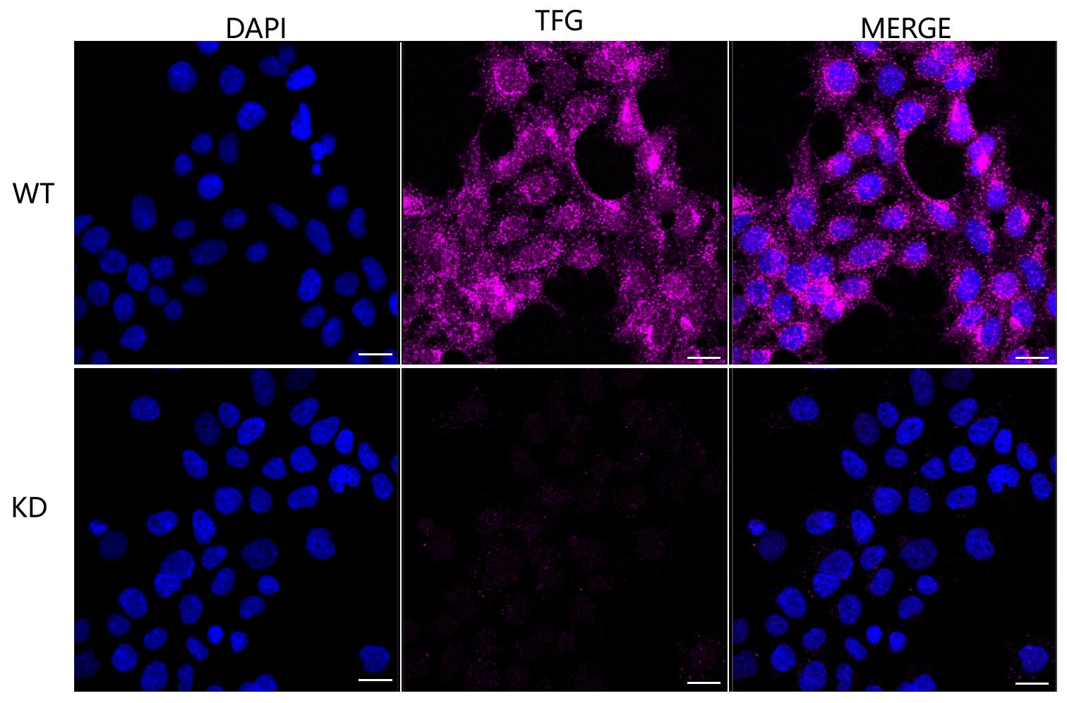 TFG Antibody (24GB2115)