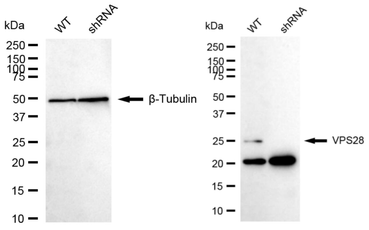 VPS28 Antibody (24GB1755)