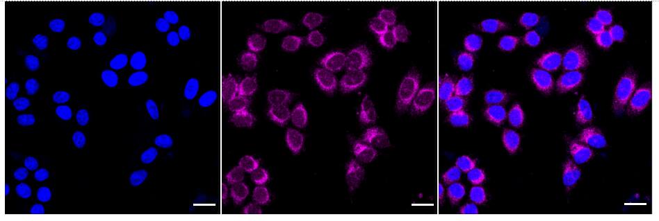 UBE4A Antibody (24GB1785)