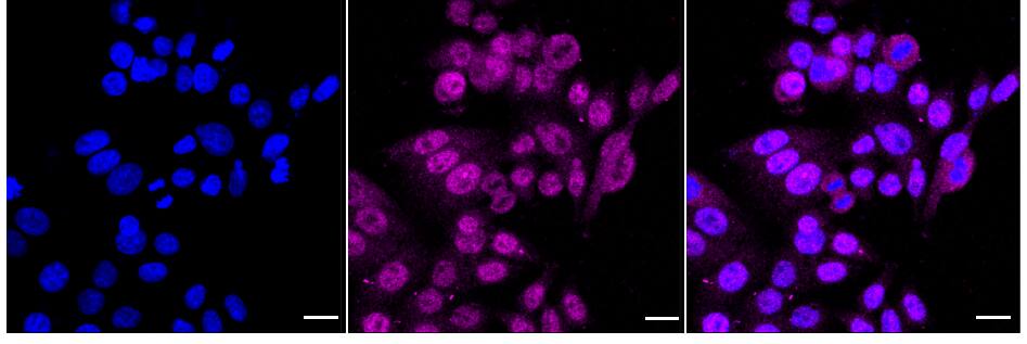 Serine racemase Antibody (24GB2345)